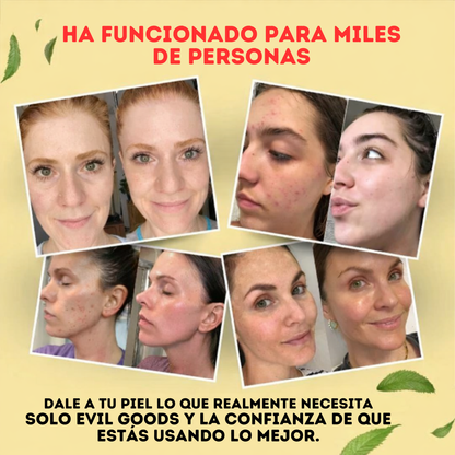 🌿 La crema que tu piel ha estado esperando